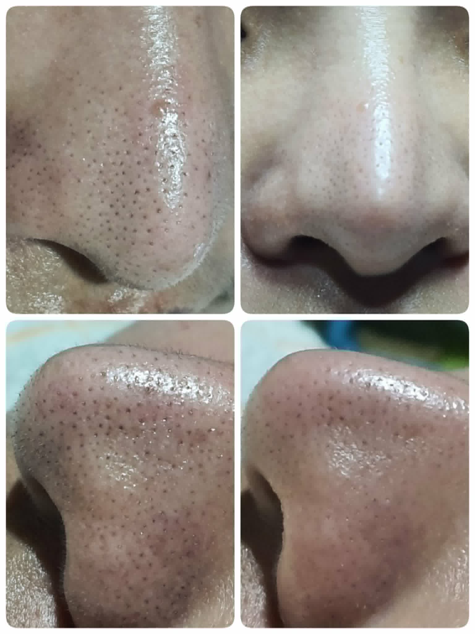 Before & After 2