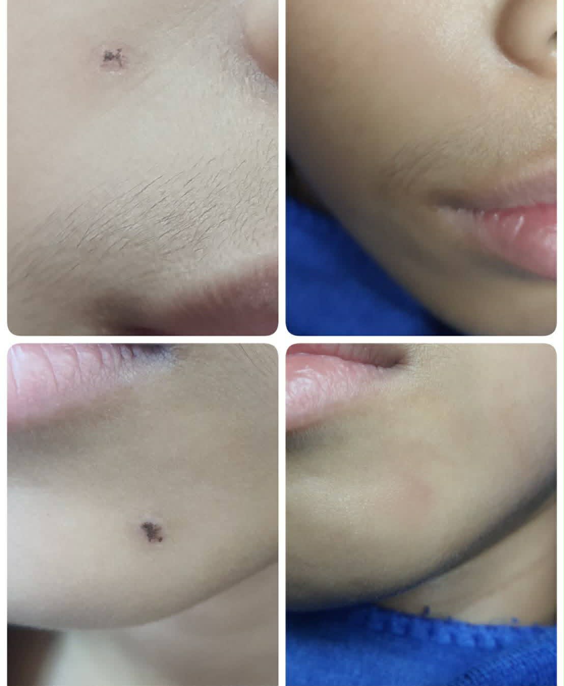 Before & After 3