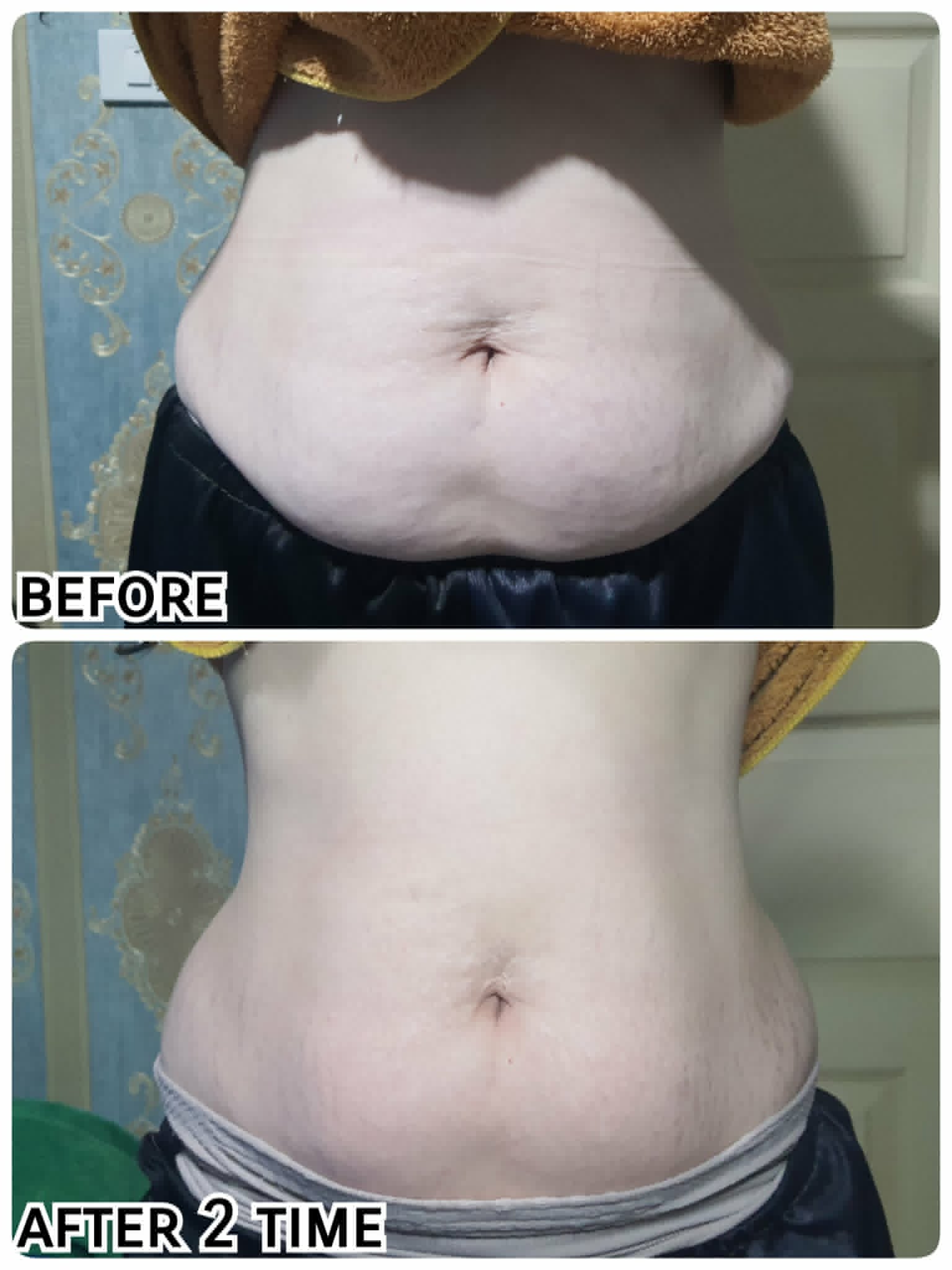 Before & After 6